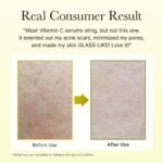 Arencia Vitamin C Booster Shot | Brightening & Skin Radiance Serum (30ml) - Image 4