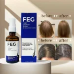 FEG PLUS Hair & Beard Regrowth Spray 50ml – Anti Hair Loss Formula with Minoxidil, Redensyl & Natural Extracts - Image 2
