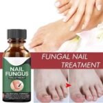 Fast Nail Fungus Treatment Serum – Nail Repair Essence for Finger & Toenail Care (All-Natural Formula) - Image 3