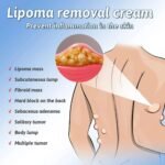 South Moon Lipoma Removal And Body Smoothing Cream 50g Herbal Natural Lump And Skin Knot Relief Ointment - Image 5