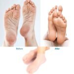 1 Pair Silicone Moisturizing Gel Foot Care Socks For Cracked Heels & Dry Skin Repair - Image 6