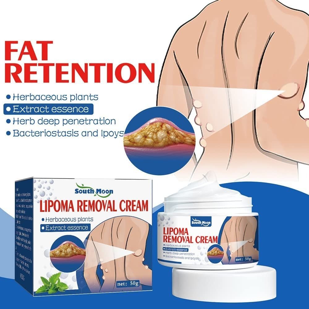 b0962c0a667fe4d197943faab145e262 South Moon Lipoma Removal And Body Smoothing Cream 50g Herbal Natural Lump And Skin Knot Relief Ointment - Image 1