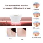 IPL Laser Hair Removal Handset System for Women & Men with Razor & Safety Glasses - Image 4