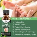 Fast Nail Fungus Treatment Serum – Nail Repair Essence for Finger & Toenail Care (All-Natural Formula) - Image 4