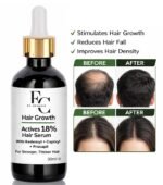 Herbal Hair Growth Serum 30ml | Rosemary & Onion Water-Based Formula - Image 3