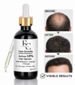 Herbal Hair Growth Serum 30ml | Rosemary & Onion Water-Based Formula - Image 2